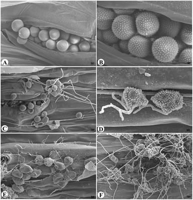 Identification of a Novel <mark class="highlighted">Alternaria alternata</mark> Strain Able to Hyperparasitize Puccinia striiformis f. sp. tritici, the Causal Agent of Wheat Stripe Rust